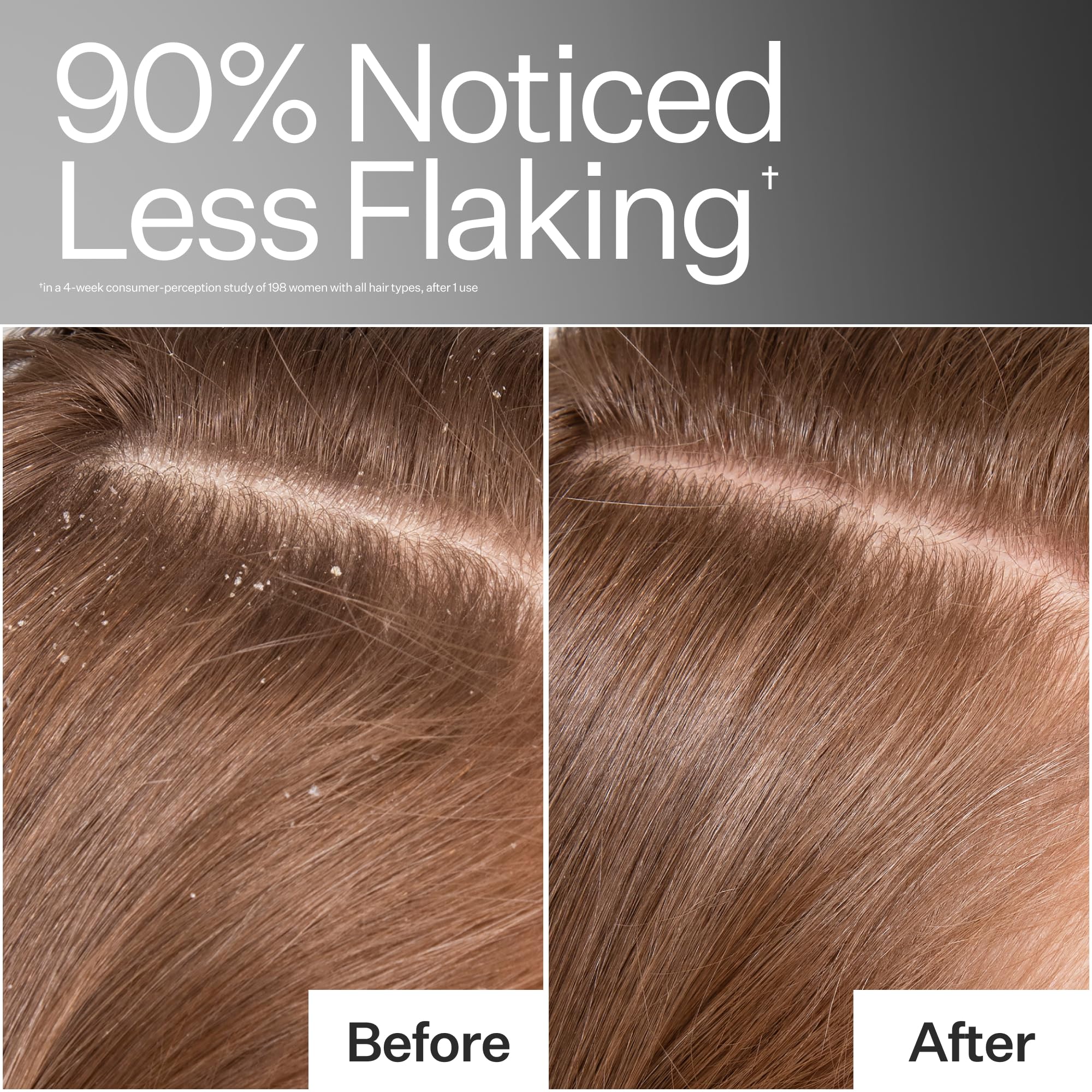 ACT+ ACRE applied to scalp during a massage for improved cleansing and circulation