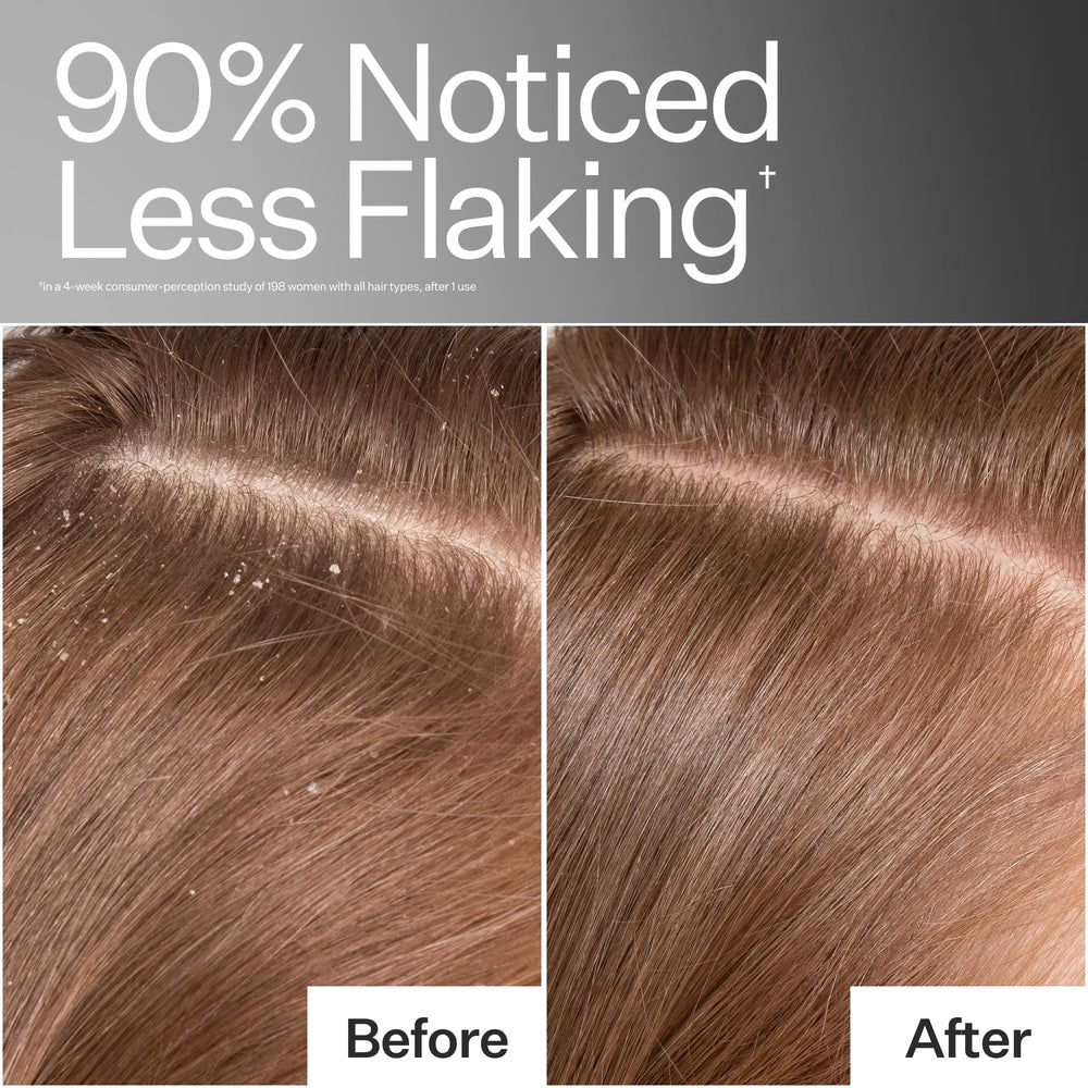 ACT+ ACRE applied to scalp during a massage for improved cleansing and circulation