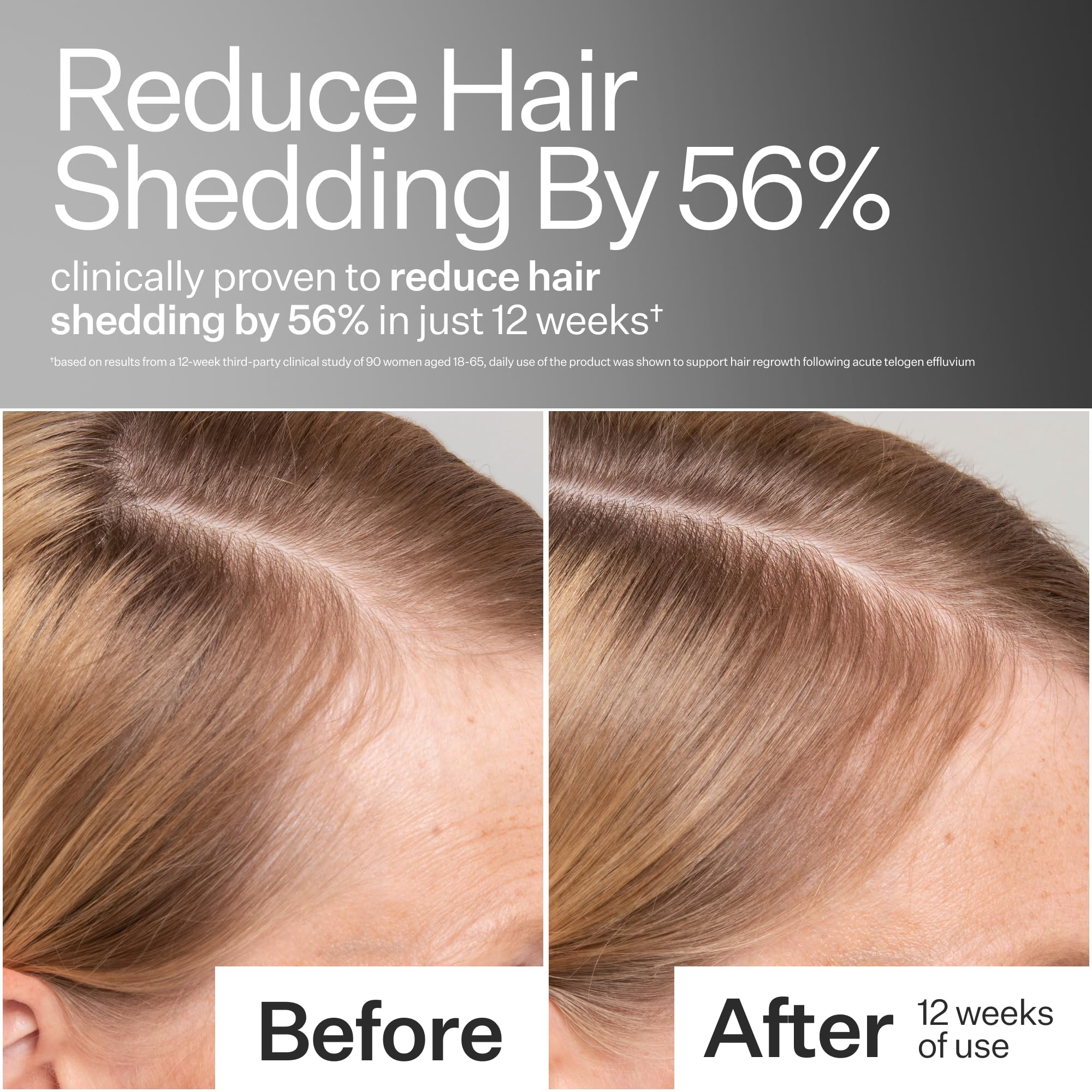 ACT+ ACRE dropper dispensing serum showing precise application and control