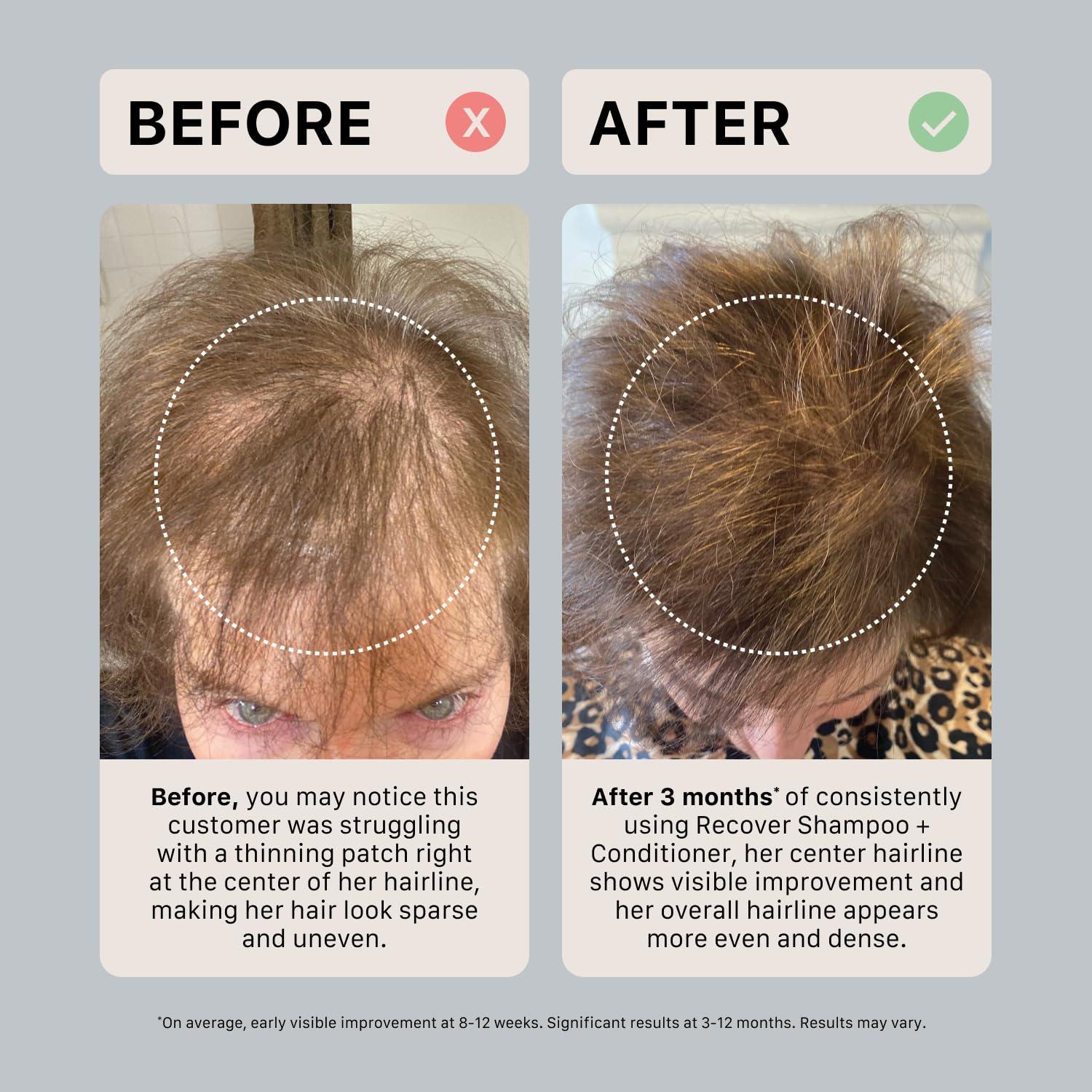 ACTIIV ingredients panel label highlighting plant-based, color-safe benefit