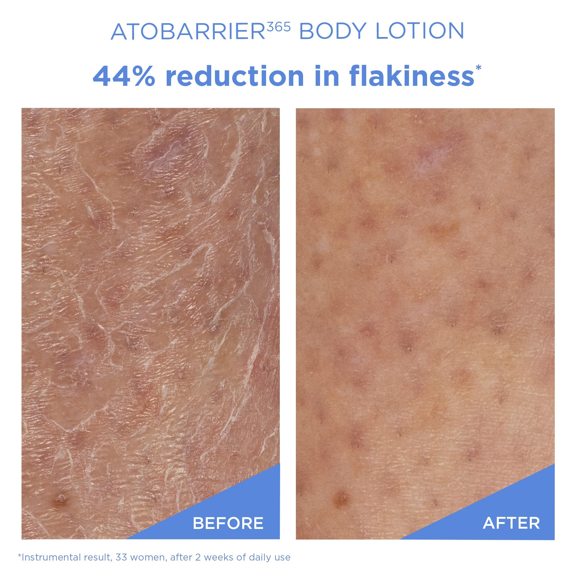 AESTURA ceramide capsule illustration highlighting targeted barrier-repair benefit