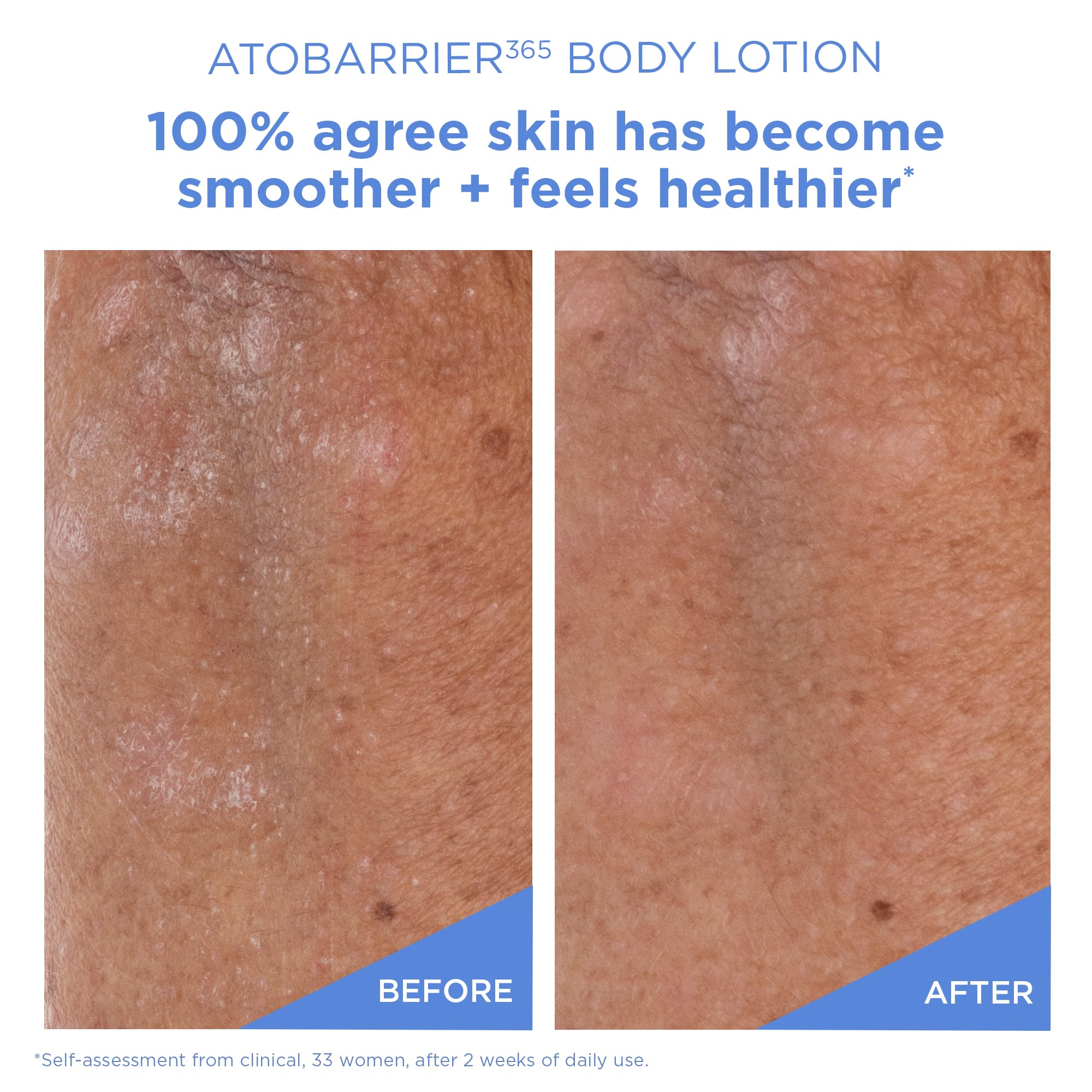 AESTURA ingredient close-up with glycerin and panthenol conveying intense hydration