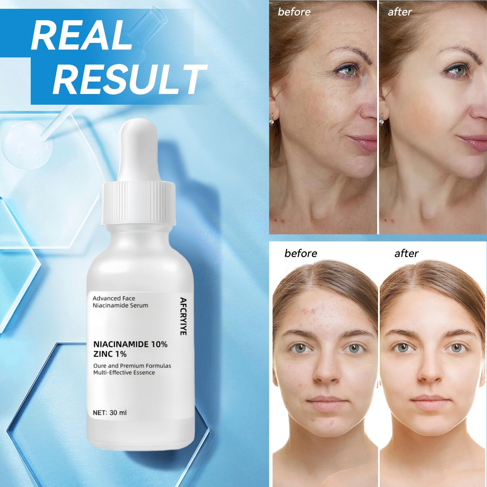 AFCRYIYE before and after illustration showing reduced pores and improved tone benefit