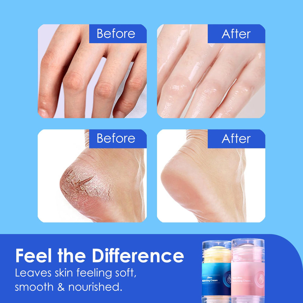 AIFUFAND applying balm to heel for targeted hydration and softer skin