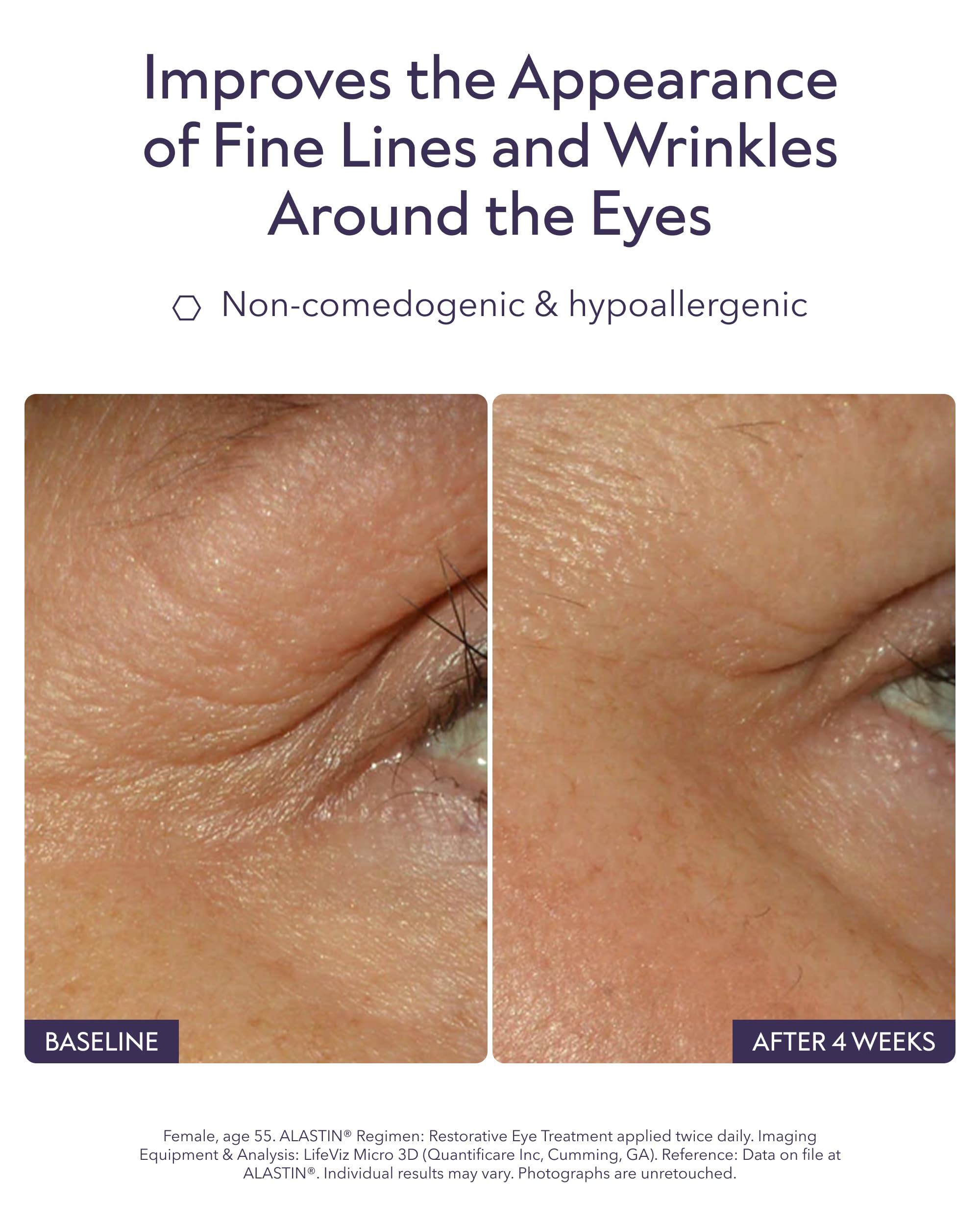 ALASTIN Skincare cream texture close-up emphasizing smooth hydration