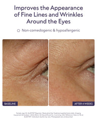 ALASTIN Skincare cream texture close-up emphasizing smooth hydration