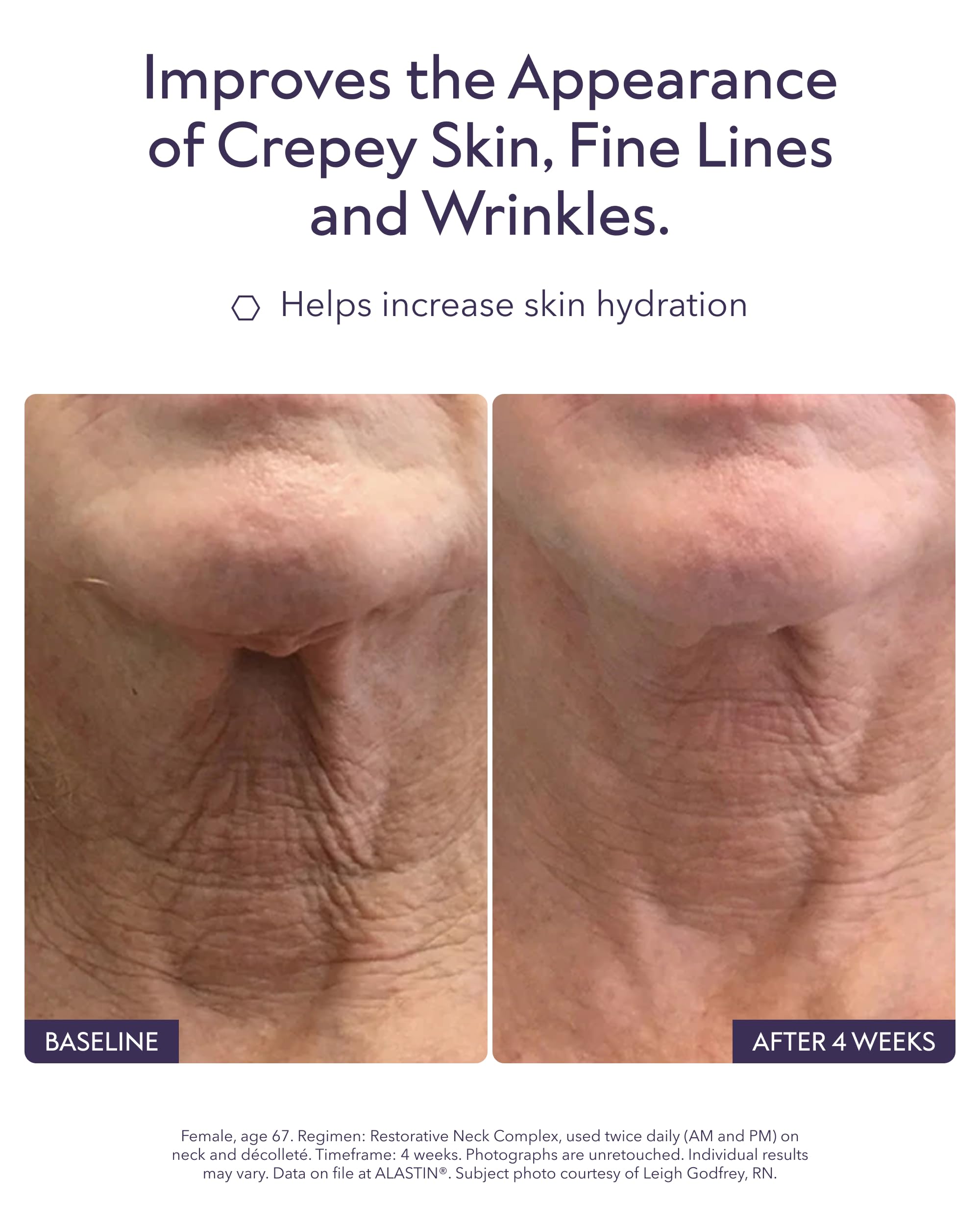 ALASTIN Skincare serum texture on hand showing lightweight hydration