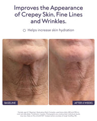 ALASTIN Skincare serum texture on hand showing lightweight hydration
