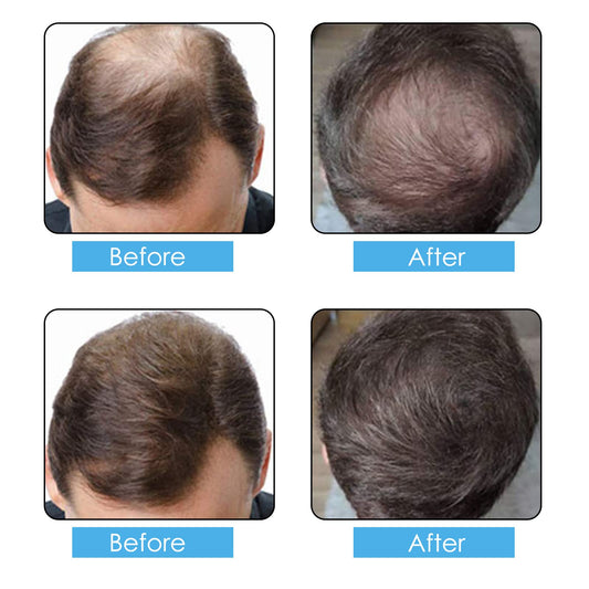 ALIVER close-up of black keratin fibers showing natural texture and undetectable blend