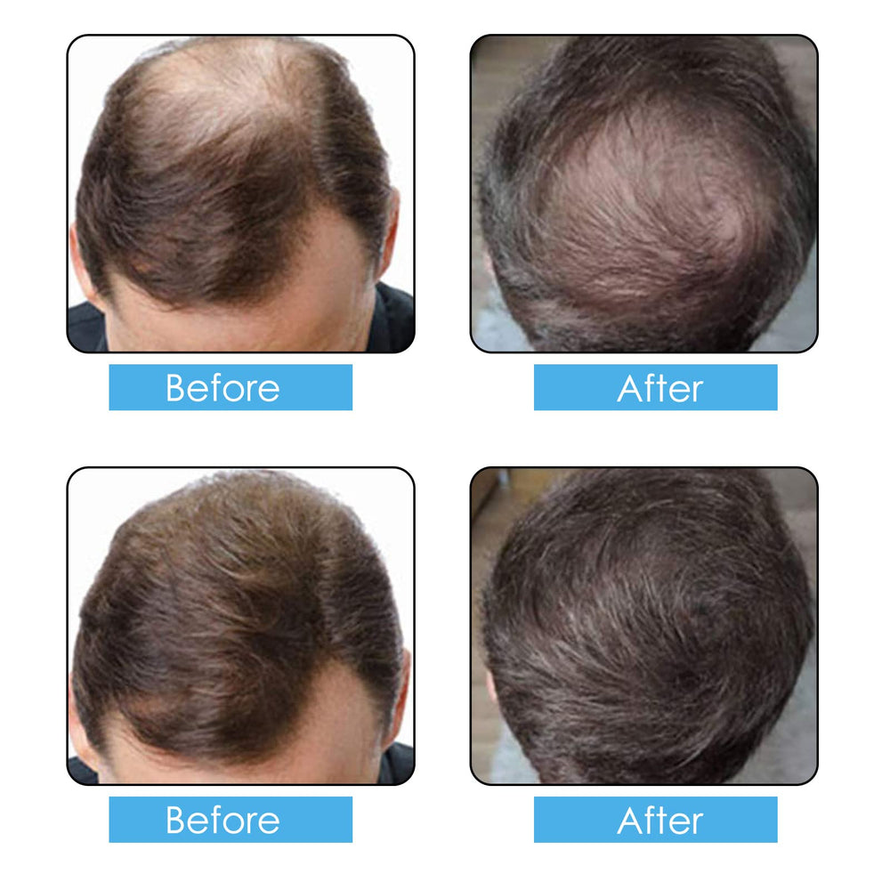 ALIVER dark brown fibers close-up showing natural keratin texture benefit