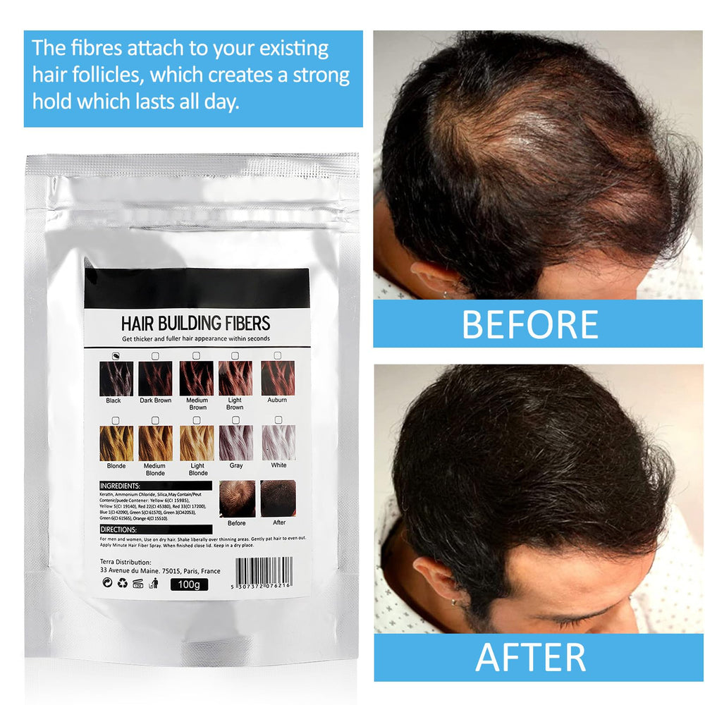 ALIVER model with finished style showing natural-looking coverage and confidence