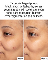Allies of Skin active ingredient close-up highlighting azelaic and kojic acids