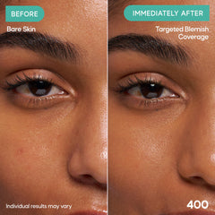 Almay Clear Complexion Concealer before and after spot coverage showing visible reduction of redness