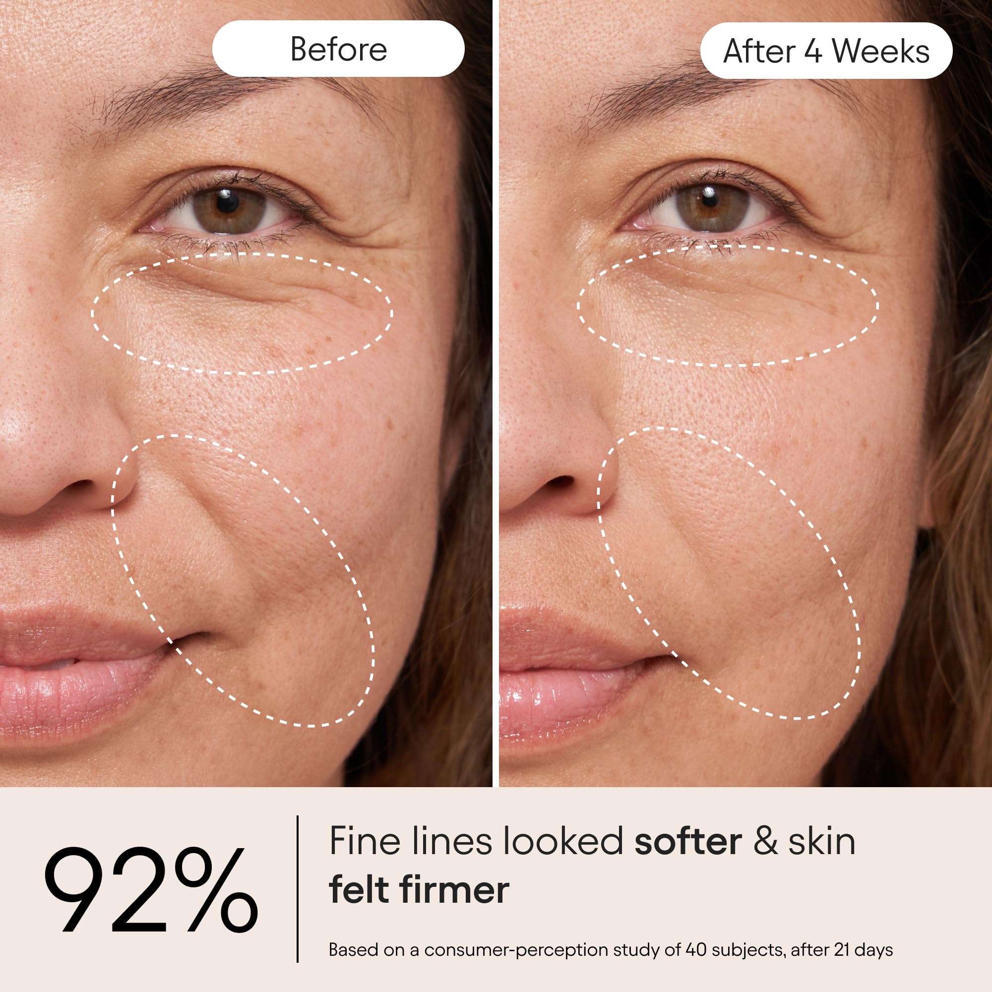 Alpyn cream droplet dispensed showing controlled application benefit