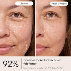 Alpyn cream droplet dispensed showing controlled application benefit