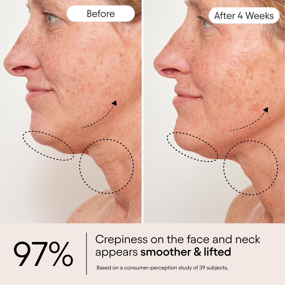 Applying Alpyn Super Sculpt Serum across décolleté for improved skin texture