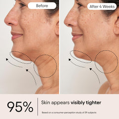 Person applying Alpyn Super Sculpt Serum to neck for lifted, smoother appearance