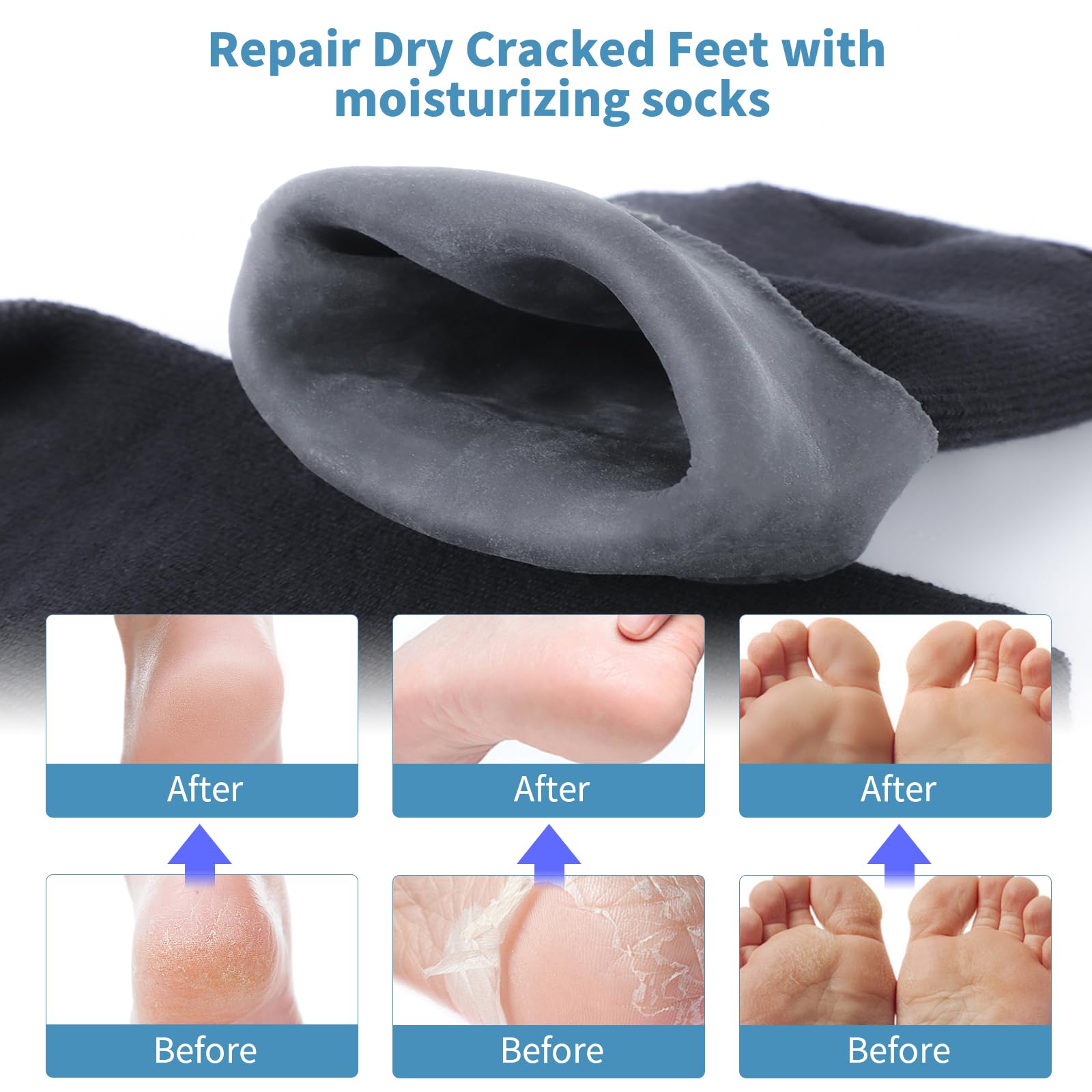 ALUROICE socks worn on a foot demonstrating secure fit and moisturizing benefit