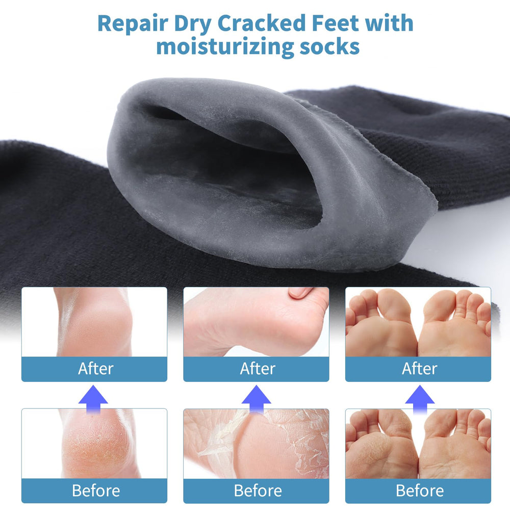 ALUROICE socks worn on a foot demonstrating secure fit and moisturizing benefit