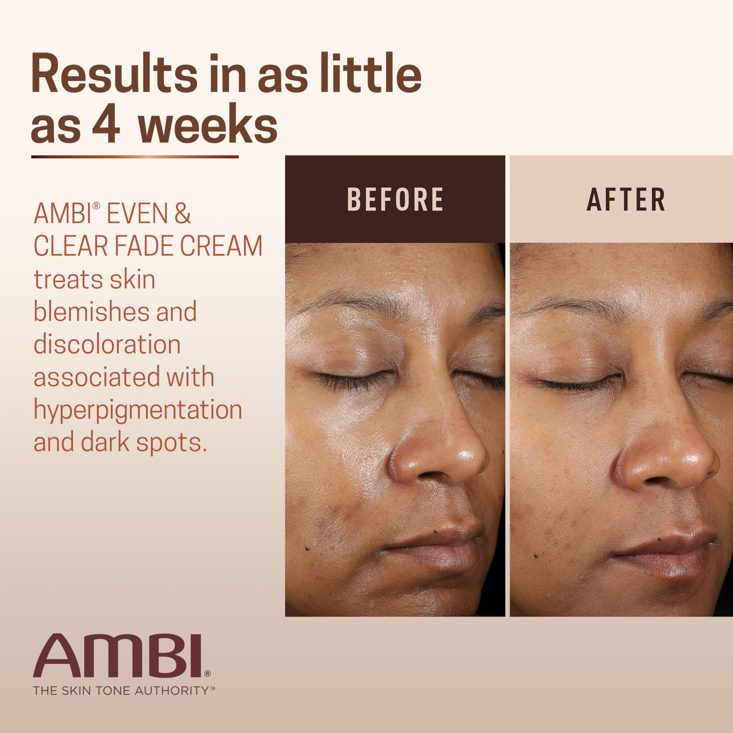 Ambi ingredient trio visual of niacinamide and vitamin C benefits