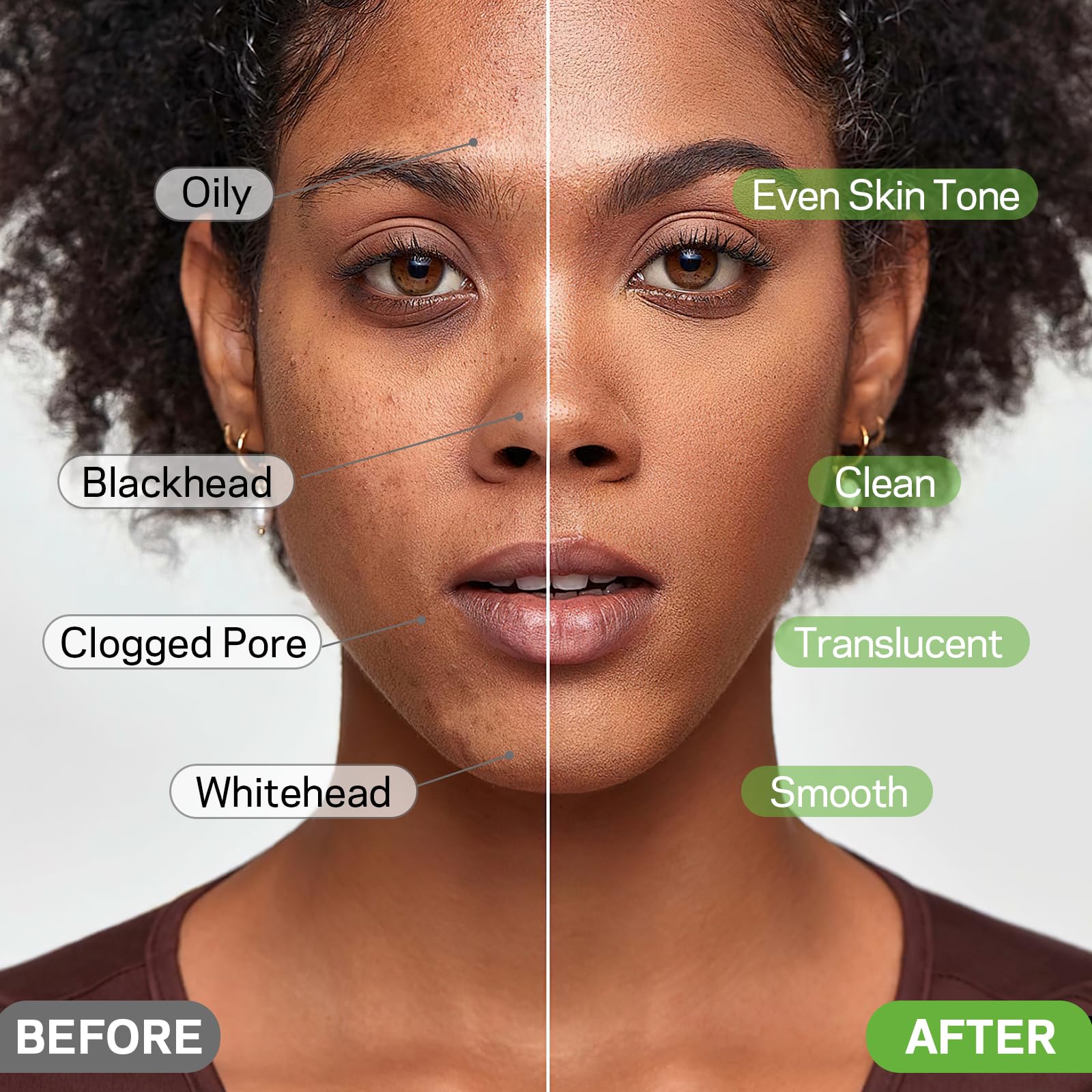 AMOADO nose area before and after use demonstrating clearer pores