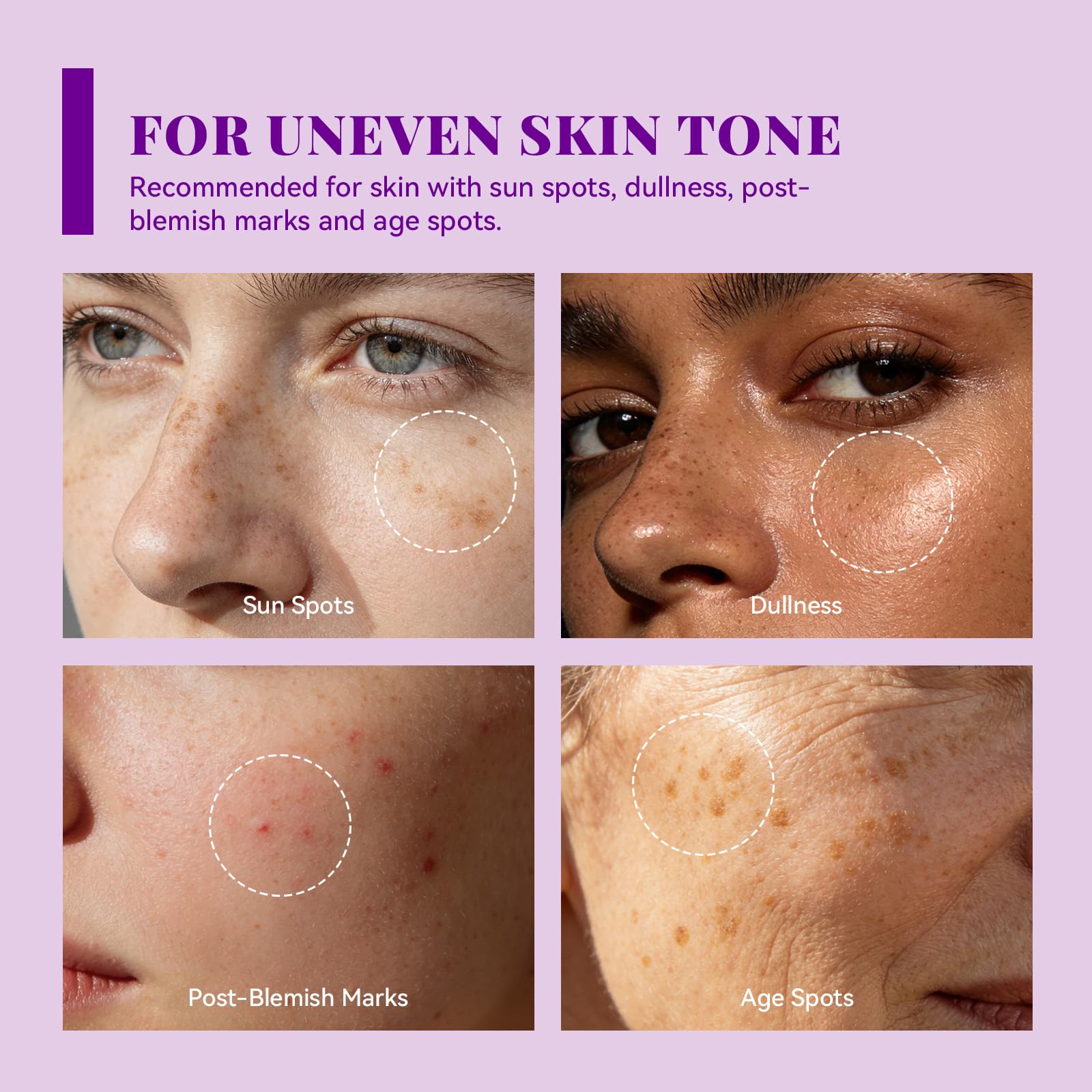 ANAI RUI label close-up listing arbutin, TXA, and niacinamide benefits