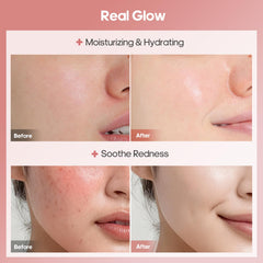 Angel Side hydrogel sheet close-up highlighting transparent, sticky texture for better absorption