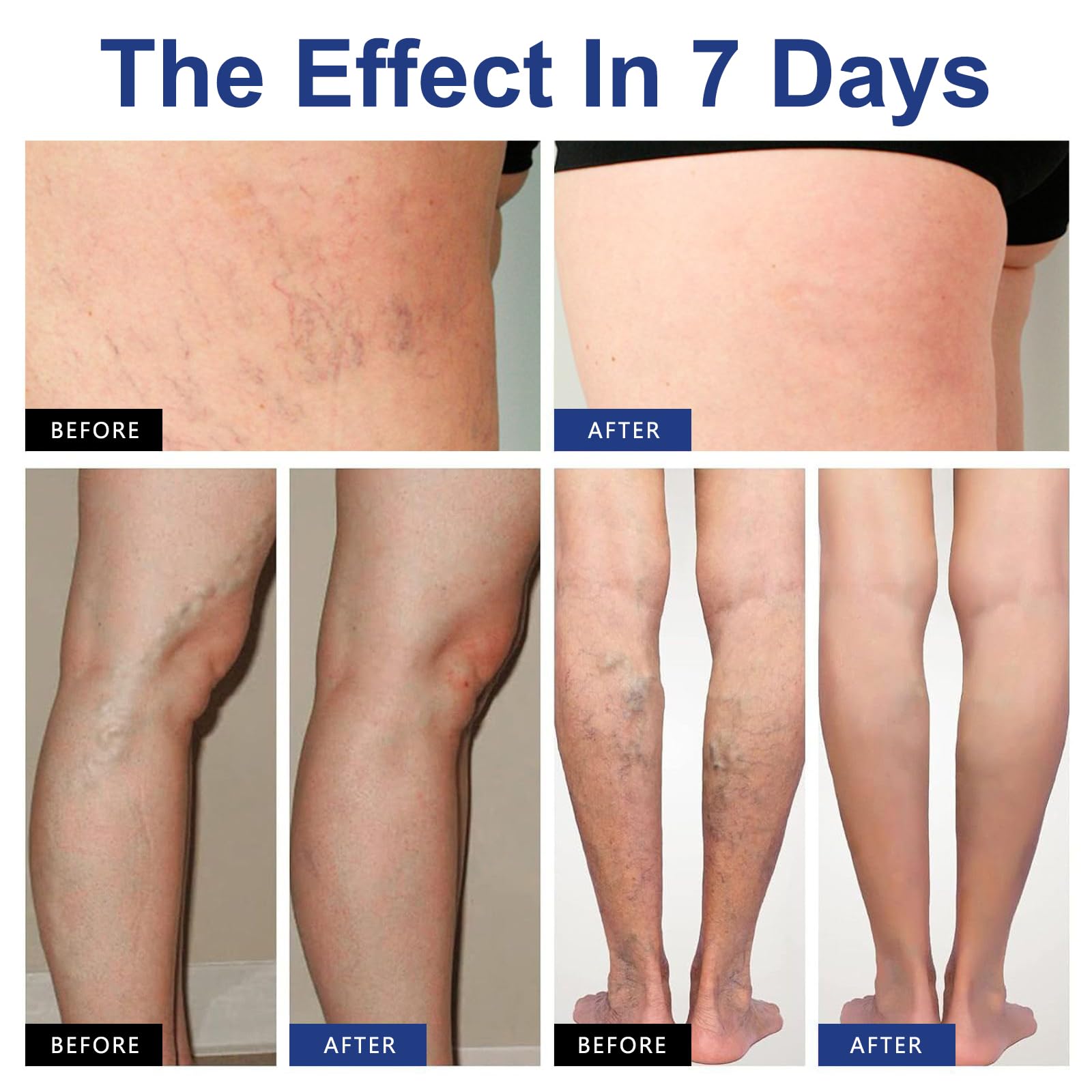 Anna's lifestyle image of standing woman showing everyday relief benefit