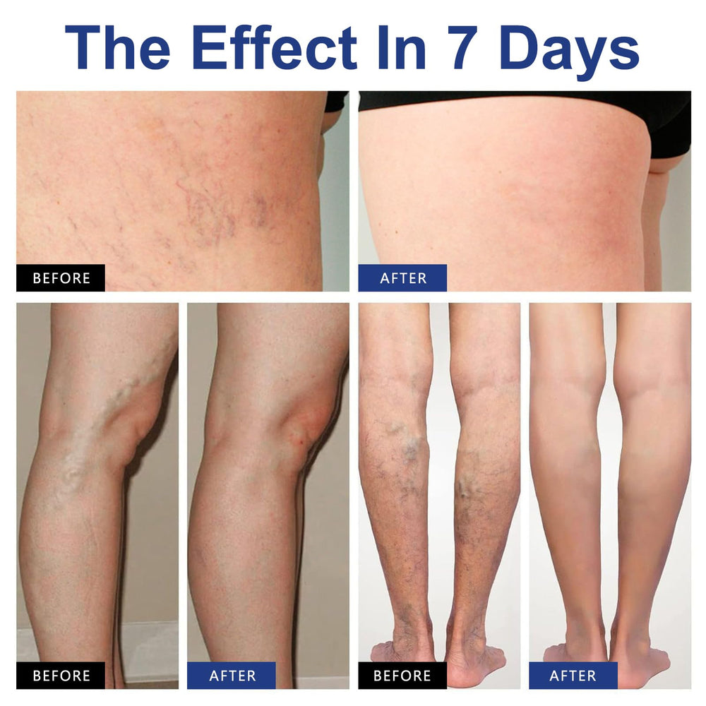Anna's lifestyle image of standing woman showing everyday relief benefit