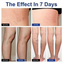 Anna's lifestyle image of standing woman showing everyday relief benefit