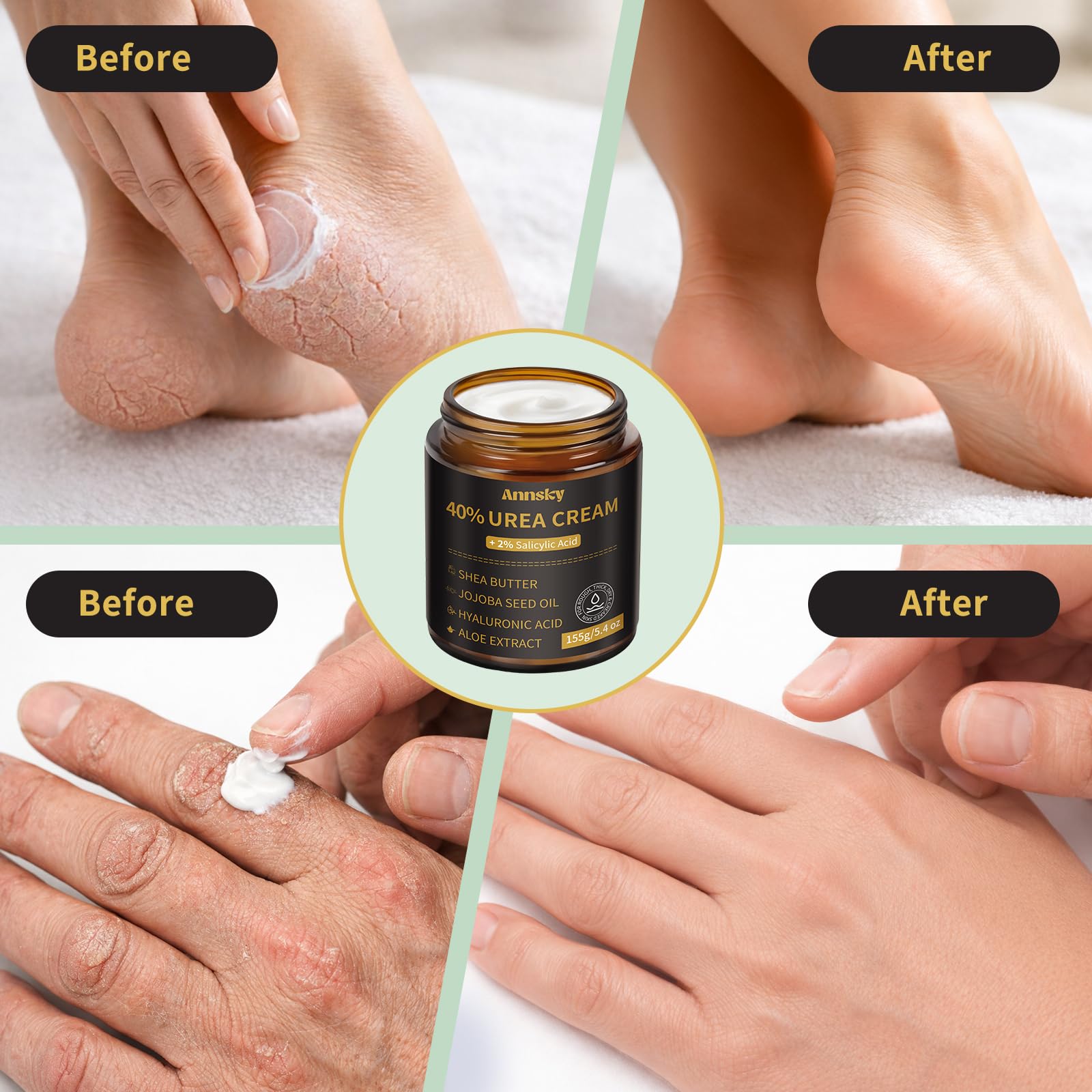 Annsky application on heel demonstrating smoothing benefit for cracked skin