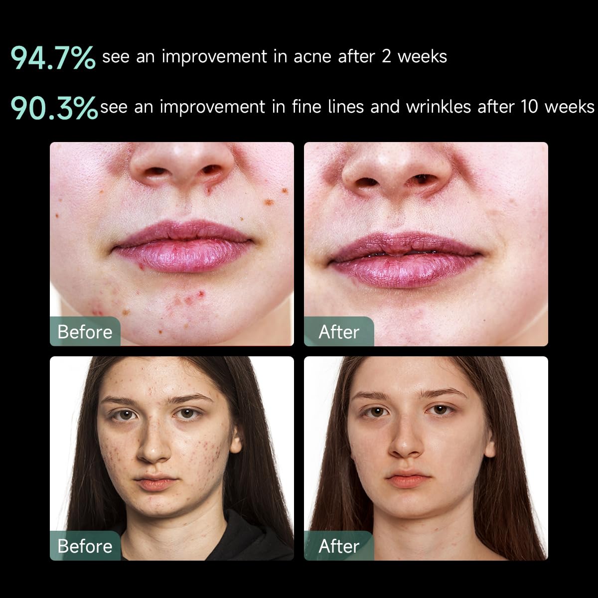 Aphrona mask worn by model demonstrating hands-free treatment convenience