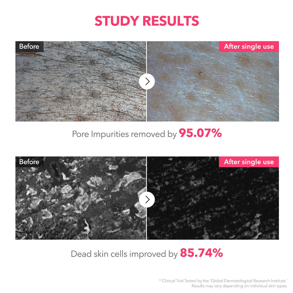 APRILSKIN ingredient visual with TXA and niacinamide showing brightening support