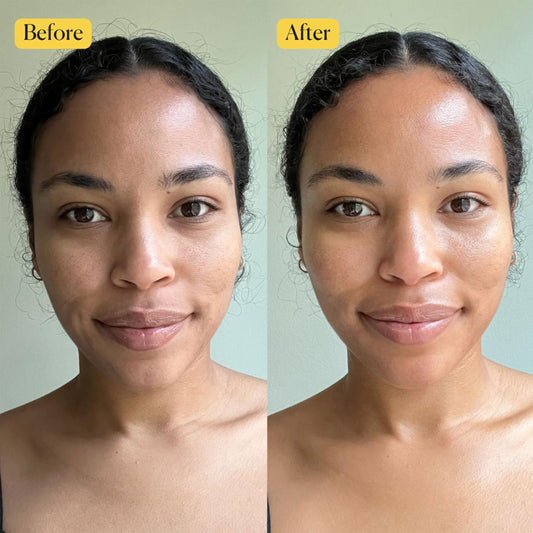 APTO dropper releasing golden oil showing quick-absorbing texture