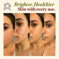 Aqia Organics Multani Mitti mixed with rose water for a soothing mask
