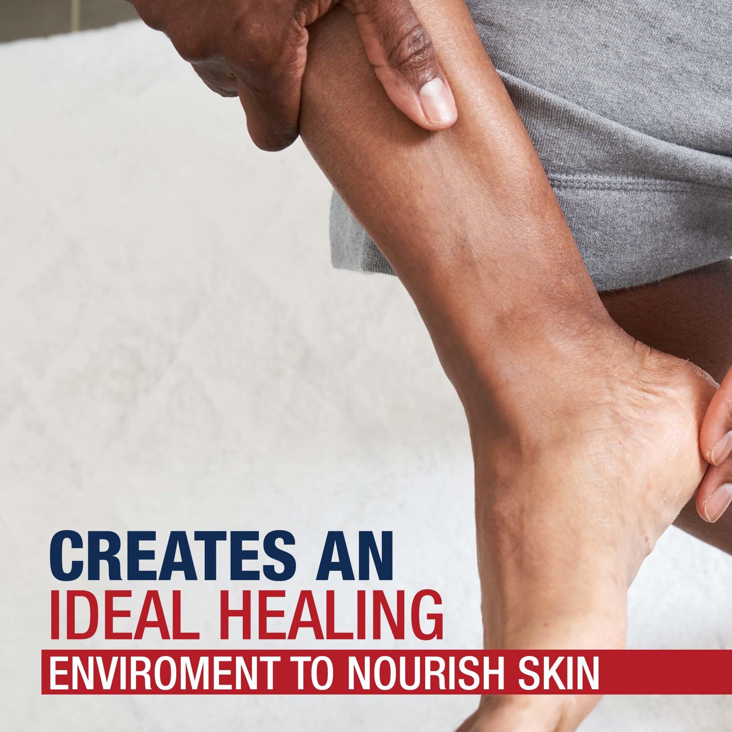 Aquaphor jar beside socks for nighttime occlusion and enhanced treatment benefit