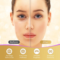 Arikit USTELIR patch applied under eye during skincare routine, delivers cooling hydration