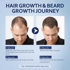 Applying Artimore solution to scalp illustrating targeted coverage and simple twice-daily routine