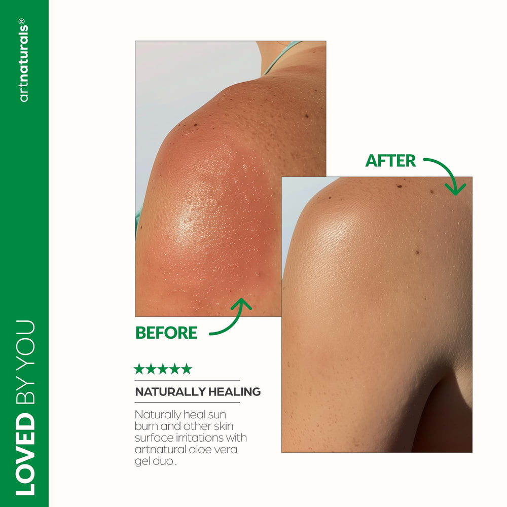 Artnaturals gel applied to hair and scalp to soothe dryness and tame frizz