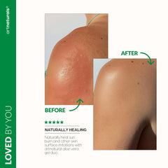 Artnaturals gel applied to hair and scalp to soothe dryness and tame frizz