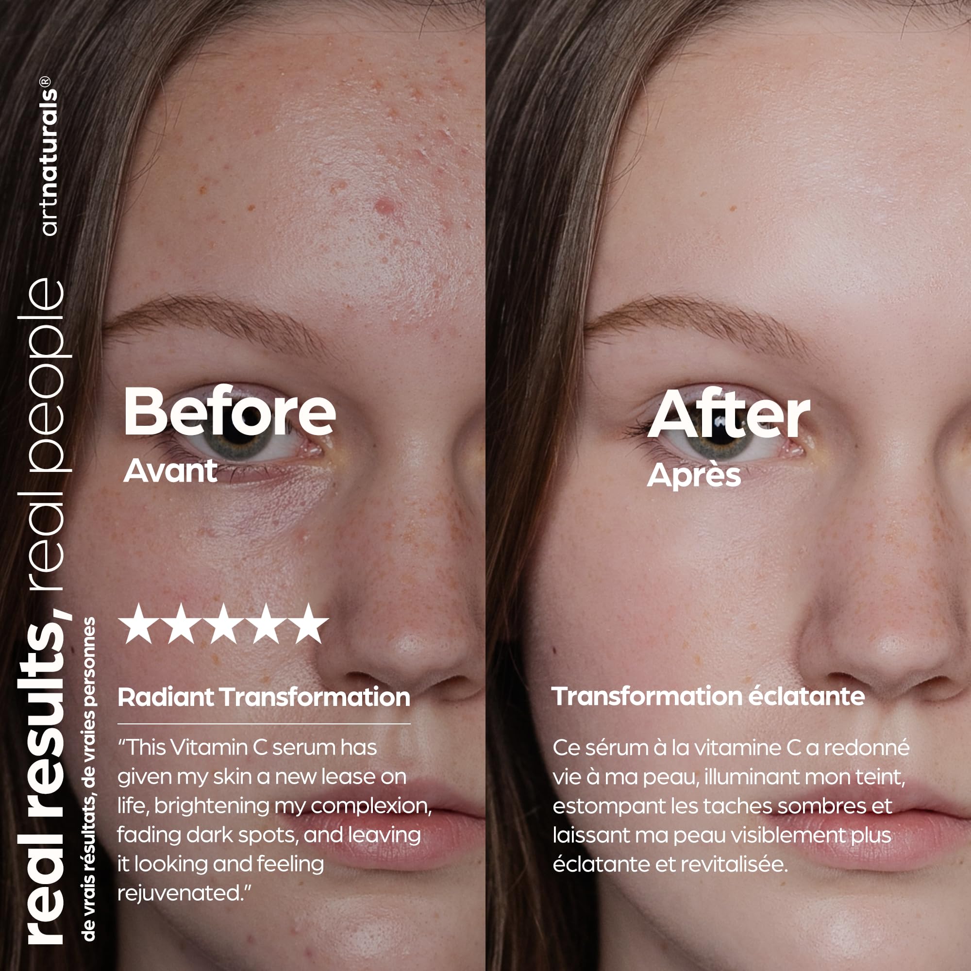 Artnaturals ingredients arranged: jojoba, aloe, hyaluronic acid for soothing hydration