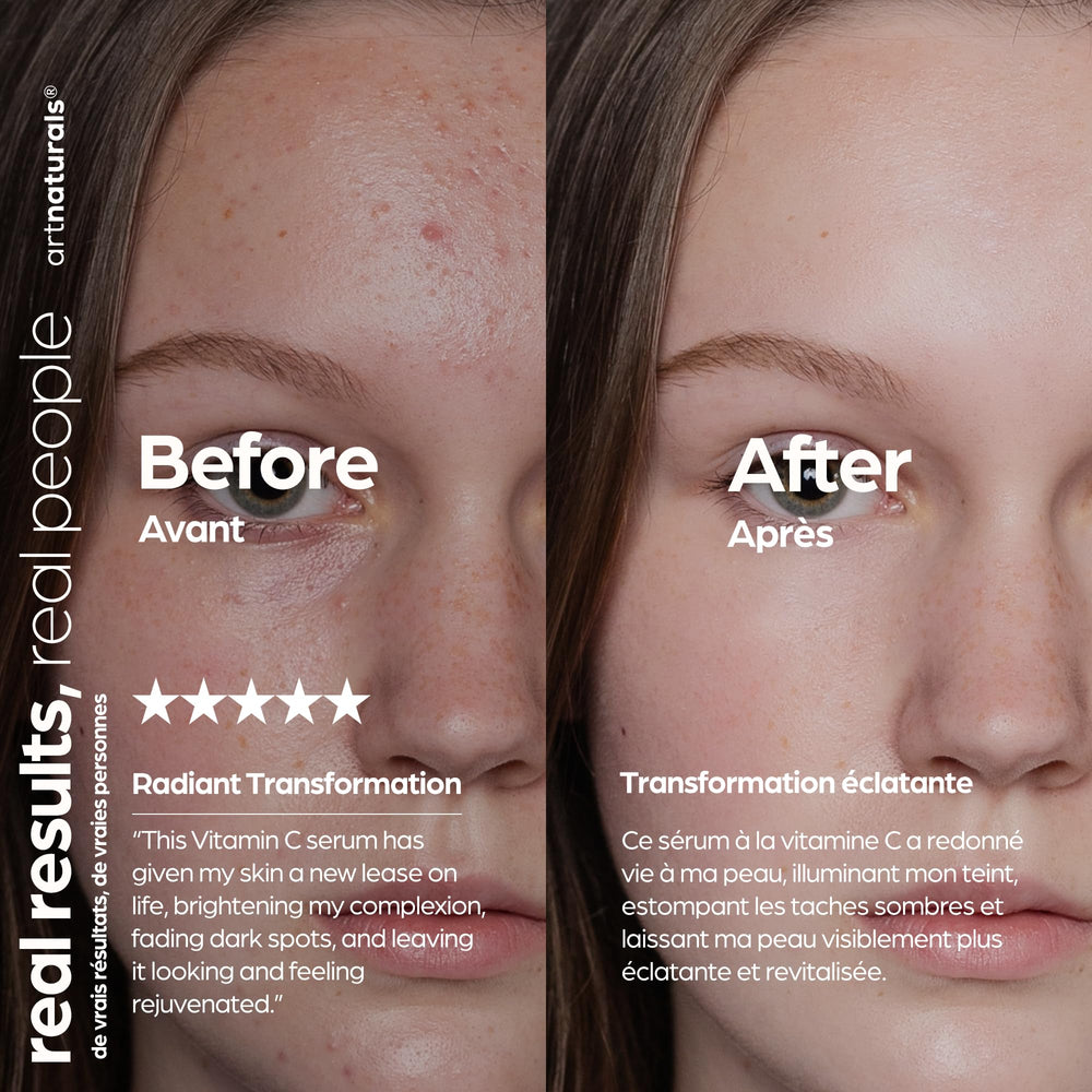 Artnaturals ingredients arranged: jojoba, aloe, hyaluronic acid for soothing hydration