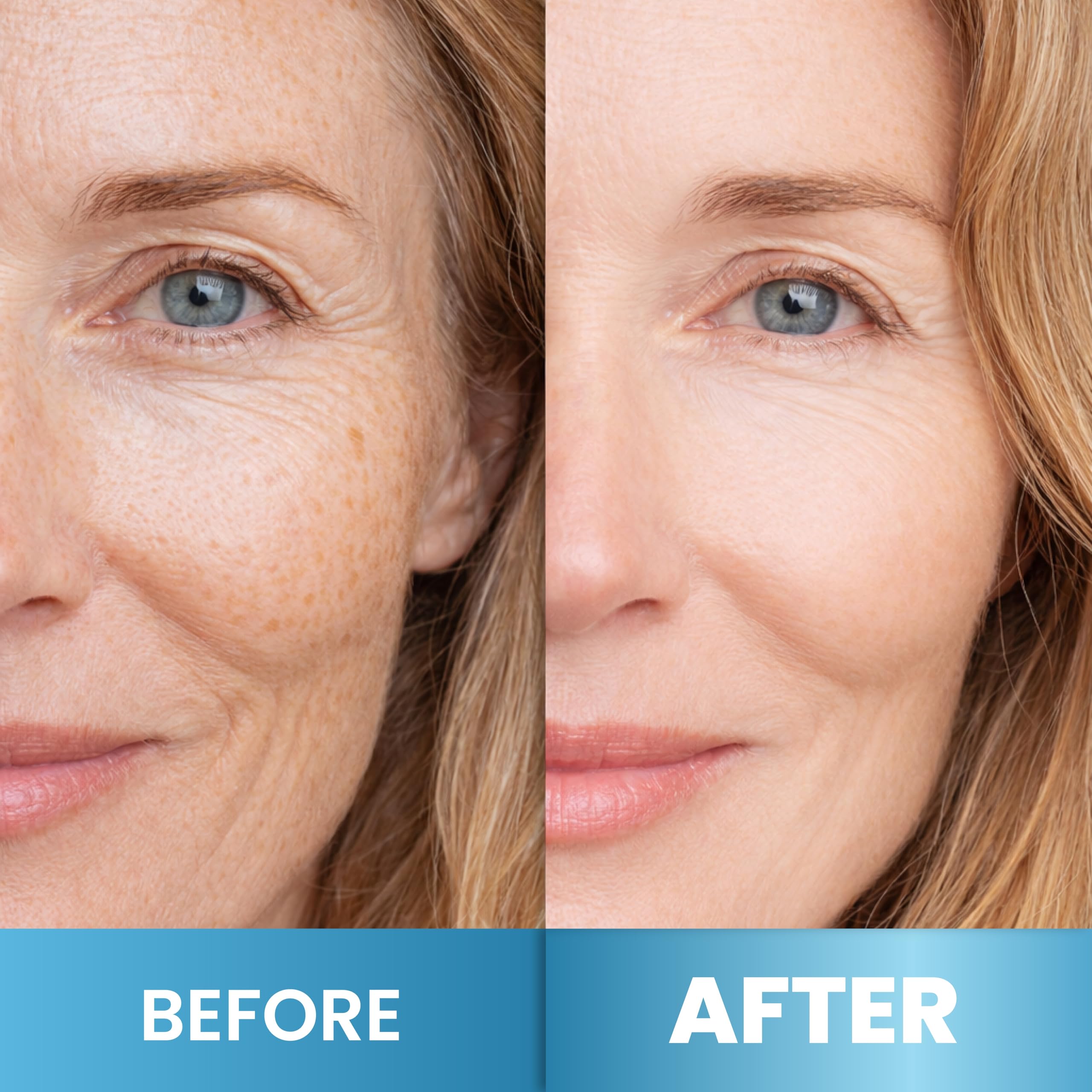 Woman applying Arvesa retinol cream to face and neck for firming and smoothing benefits