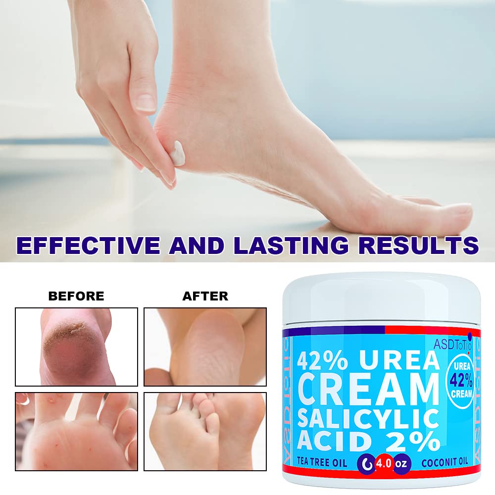 ASDToTio 4 oz tube in hand showing compact travel-friendly size and control