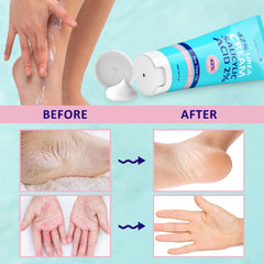 ASDToTio cream applied before bed with socks illustrating overnight intensive care