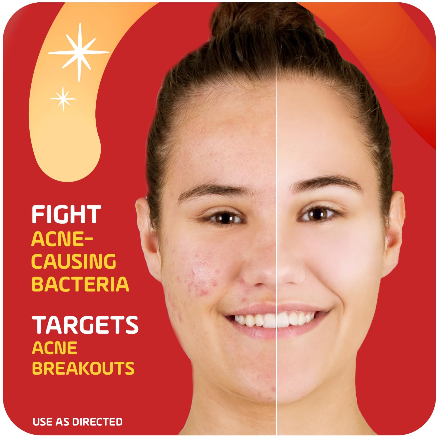 Asepxia cream on fingertip ready for spot application to calm blemishes
