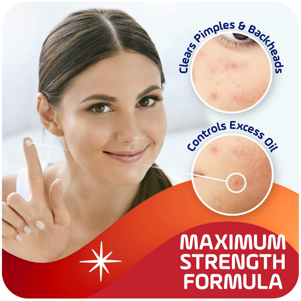 Asepxia texture close-up revealing drying cream consistency for targeted application