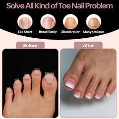 ASONRL tips beside ruler showing extra-wide fit and scale