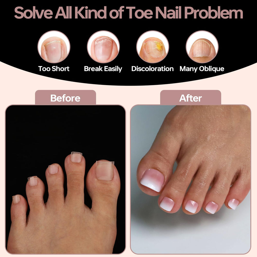 ASONRL side profile of square-shaped tip showing full-cover clean edge benefit
