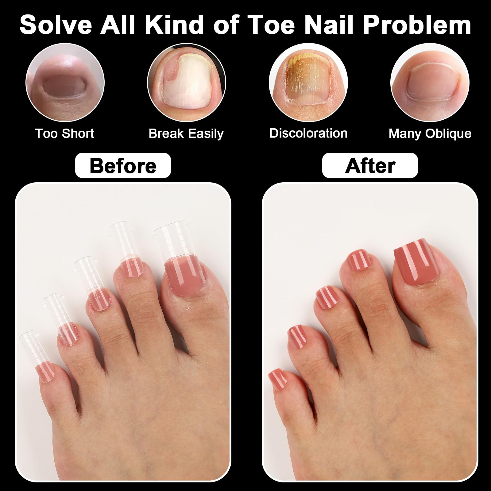 asonrl thin 0.3mm edge detail, natural curvature benefit